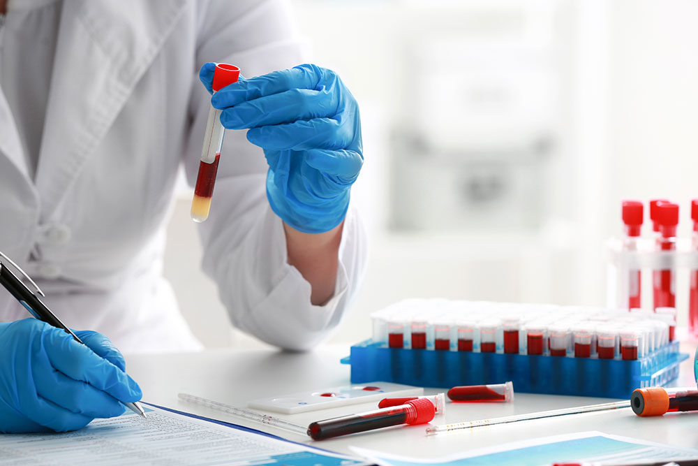 A laboratory technician wearing blue gloves holds a test tube of blood while recording results at a lab bench with multiple blood samples.